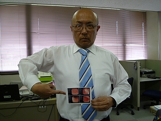 鼻からにしますか？口からにしますか？
