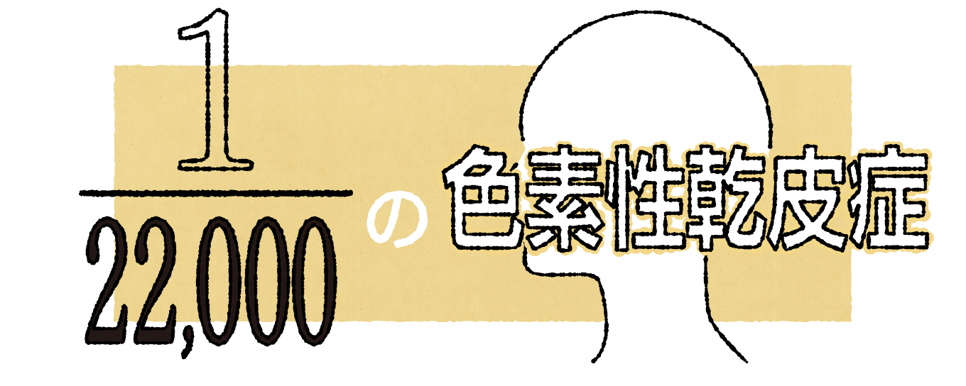 1/22,000の色素性乾皮症